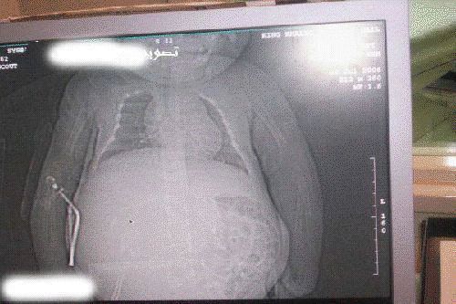 :	5.jpg
: 1463
:	40.8 