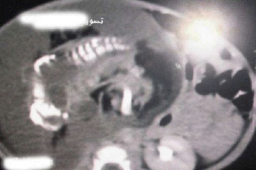 :	6.jpg
: 1424
:	39.4 