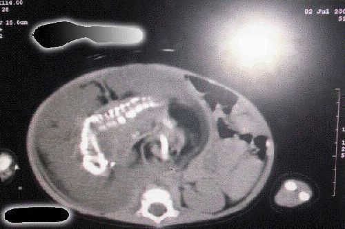 :	7.jpg
: 1349
:	41.2 